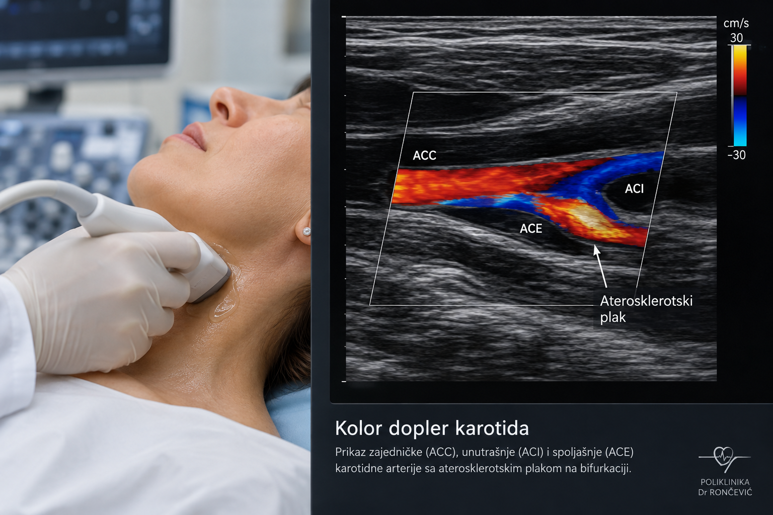 Kolor dopler krvnih sudova: šta pokazuje i kada se radi? 1 Kolor dopler karotida – ultrazvučni pregled krvnih sudova vrata