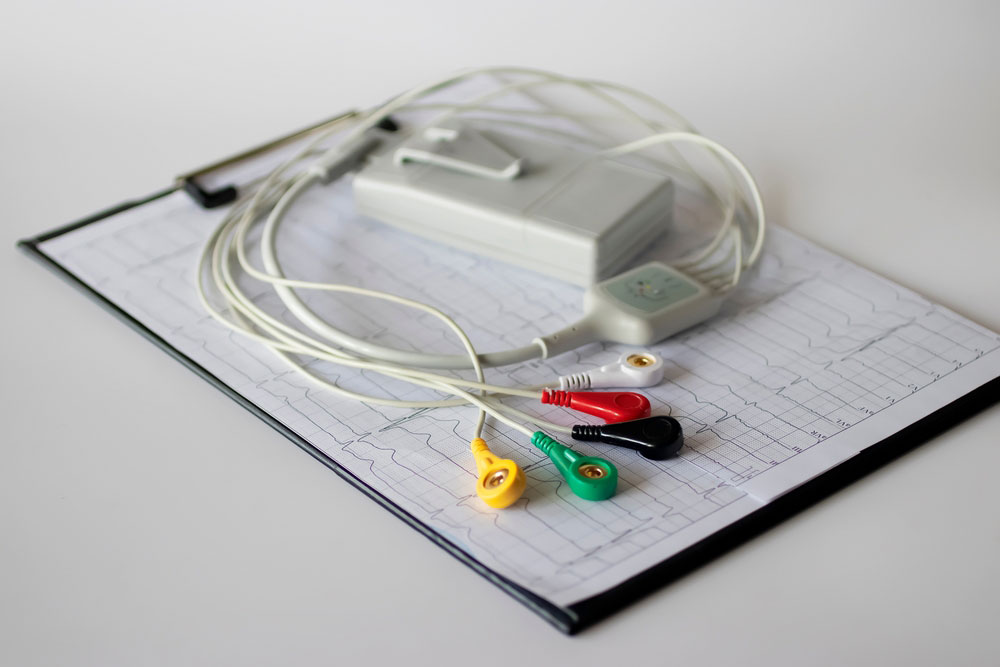 Uredjaj za holter EKG